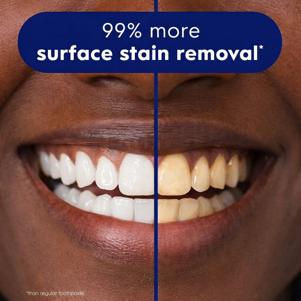 Purple Teeth Whitening 2.0 Strips