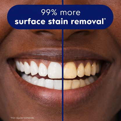 Purple Teeth Whitening 2.0 Strips